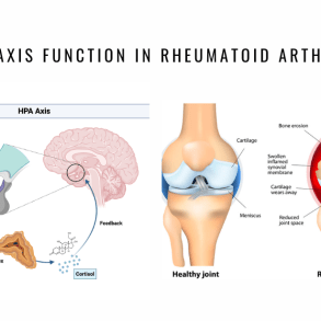 hypothalamic pituitary adrenal arthritis new