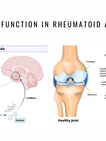 hypothalamic pituitary adrenal arthritis new