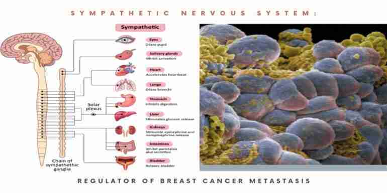 Sympathetic Nervous System Regulator Breast Cancer Metastasis