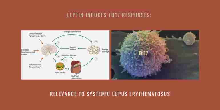 Leptin Induces Th17 Systemic Lupus Erythematosus