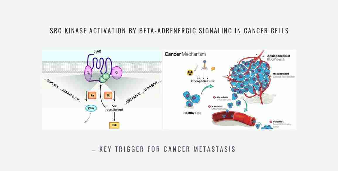 Src Kinase beta adrenergic signaling cancer metastasis