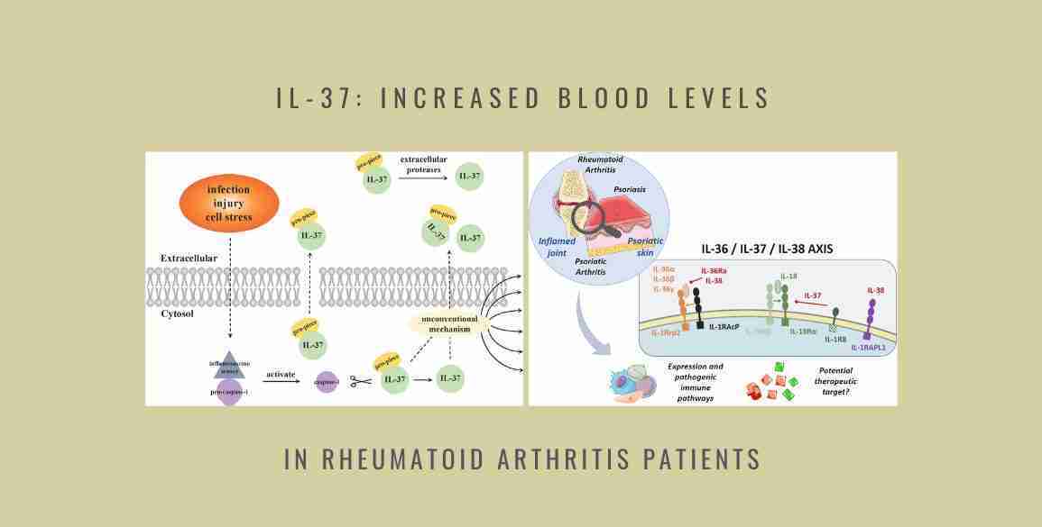 IL-37 Increased Rheumatoid Arthritis