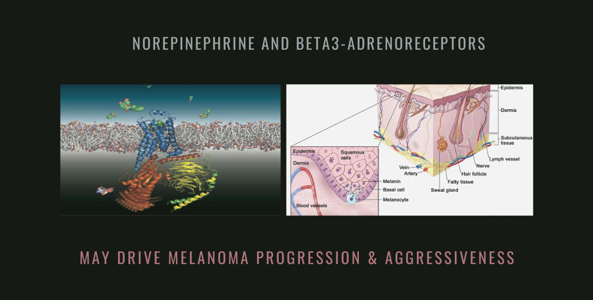 norepinephrine beta3-Adrenoreceptors Melanoma