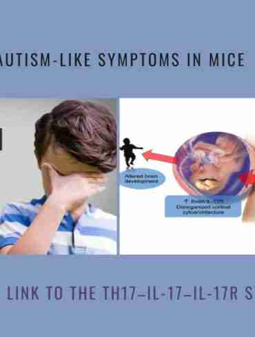 Autism-Like Symptoms Mice link Th17 IL-17