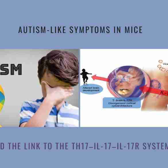 Autism-Like Symptoms Mice link Th17 IL-17