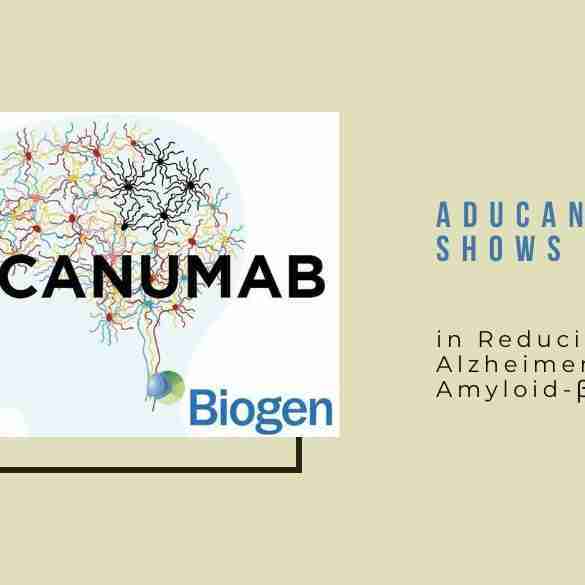 Aducanumab Shows Promise Alzheimers