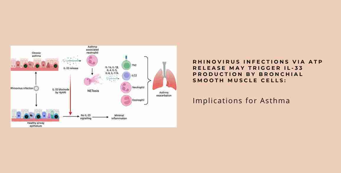 Rhinovirus infections IL-33 bronchial(