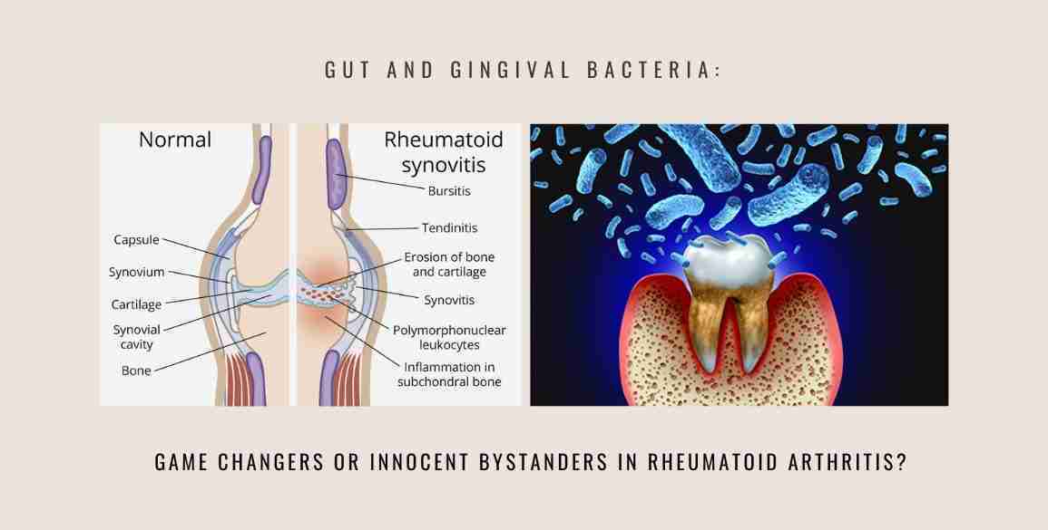 gut bacteria game changers arthritis