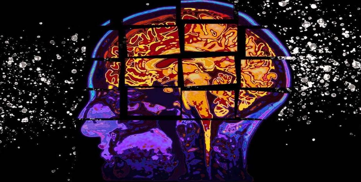 Cognitive Decline Alzheimer’s
