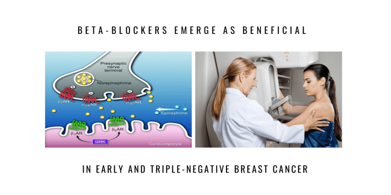 beta blockers benefactors early breast cancer