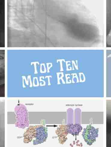 The Top Ten Most-Read Brainimmune