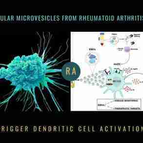 Extracellular Microvesicles Rheumatoid Arthritis Dendritic Cell Activation