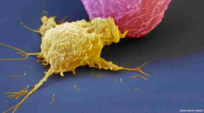 Natural killer cells cancer
