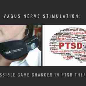 Vagus Nerve Stimulation Game Changer PTSD Therapy
