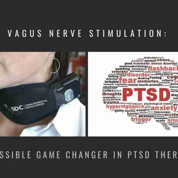 Vagus Nerve Stimulation Game Changer PTSD Therapy