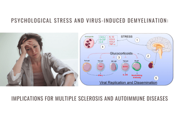 stress virus demyelination multiple sclerosis