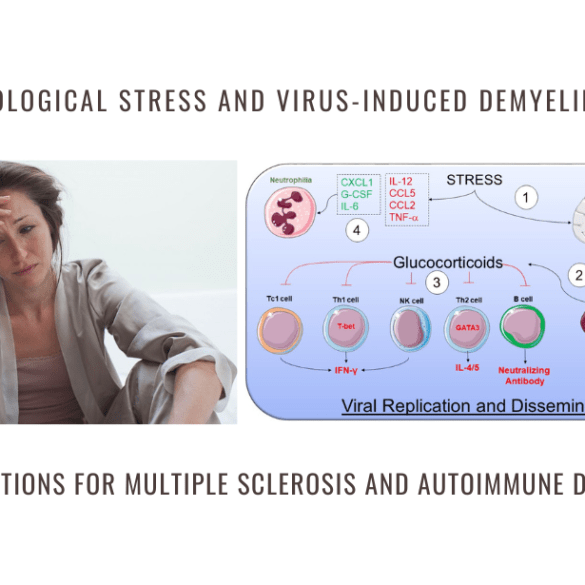stress virus demyelination multiple sclerosis